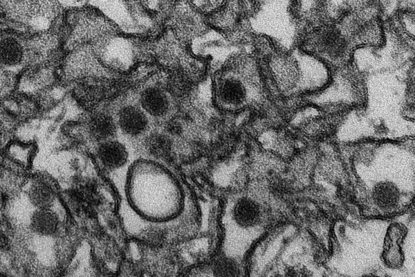 Zika-Virus. Foto: dts Nachrichtenagentur